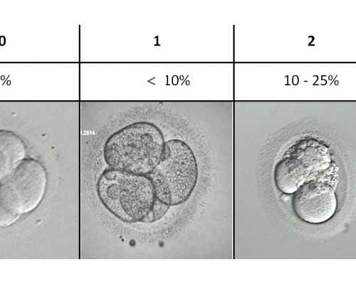 试管婴儿饮食营养指南与三代技术解析
