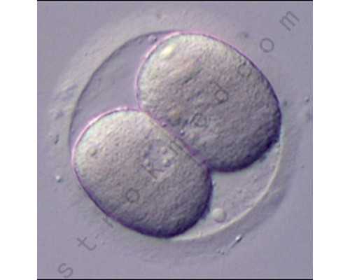 揭秘双胞胎备孕的隐藏秘诀