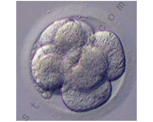 探索三代试管助孕费用与优势，实现生育梦想