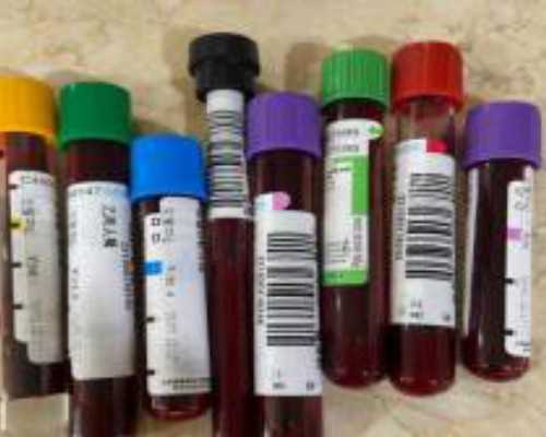 上海国妇婴医院三代试管技术解析：性别选择与费用明细